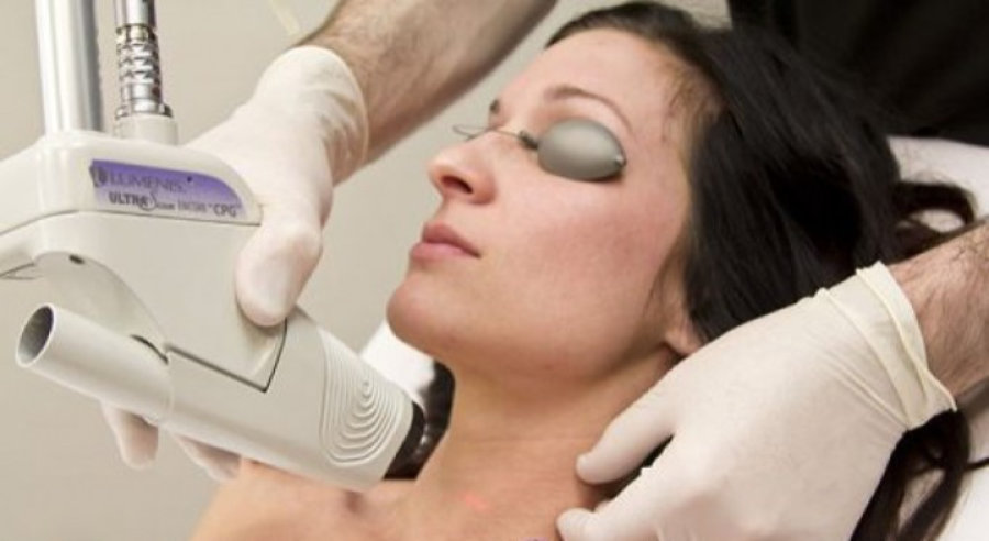 cosmetic laser procedure